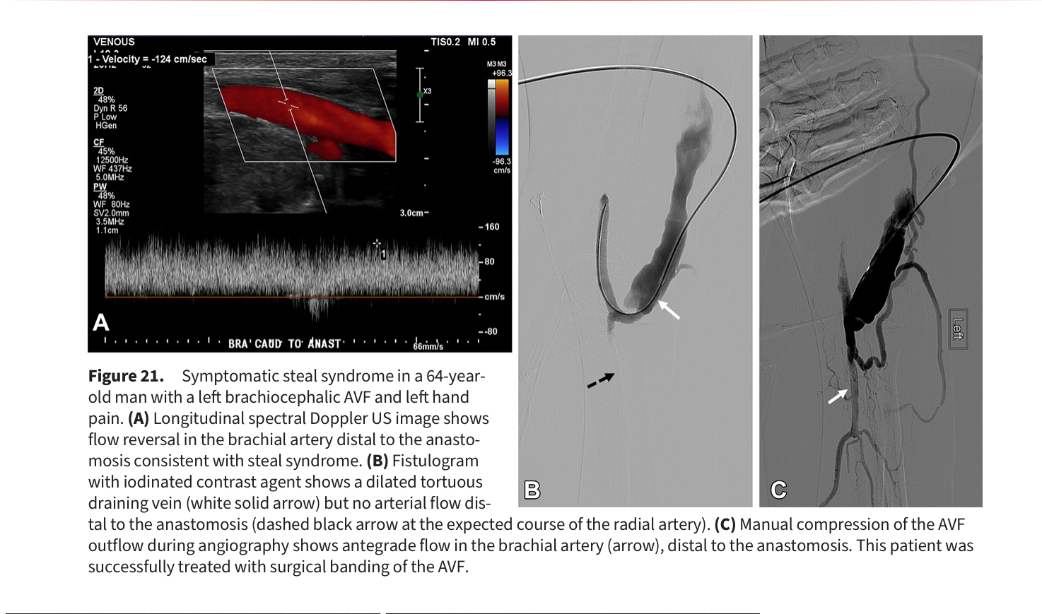 Figure 22