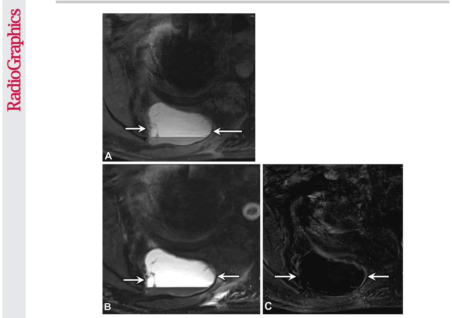 Figure 22