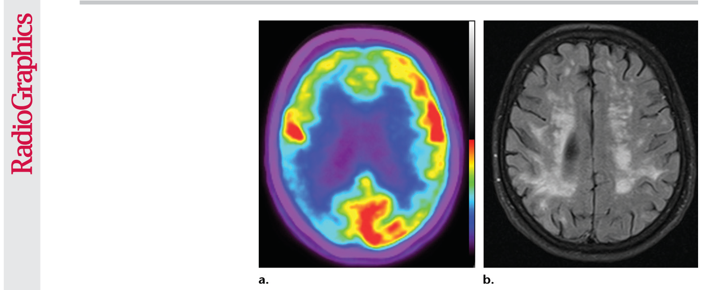Figure 22