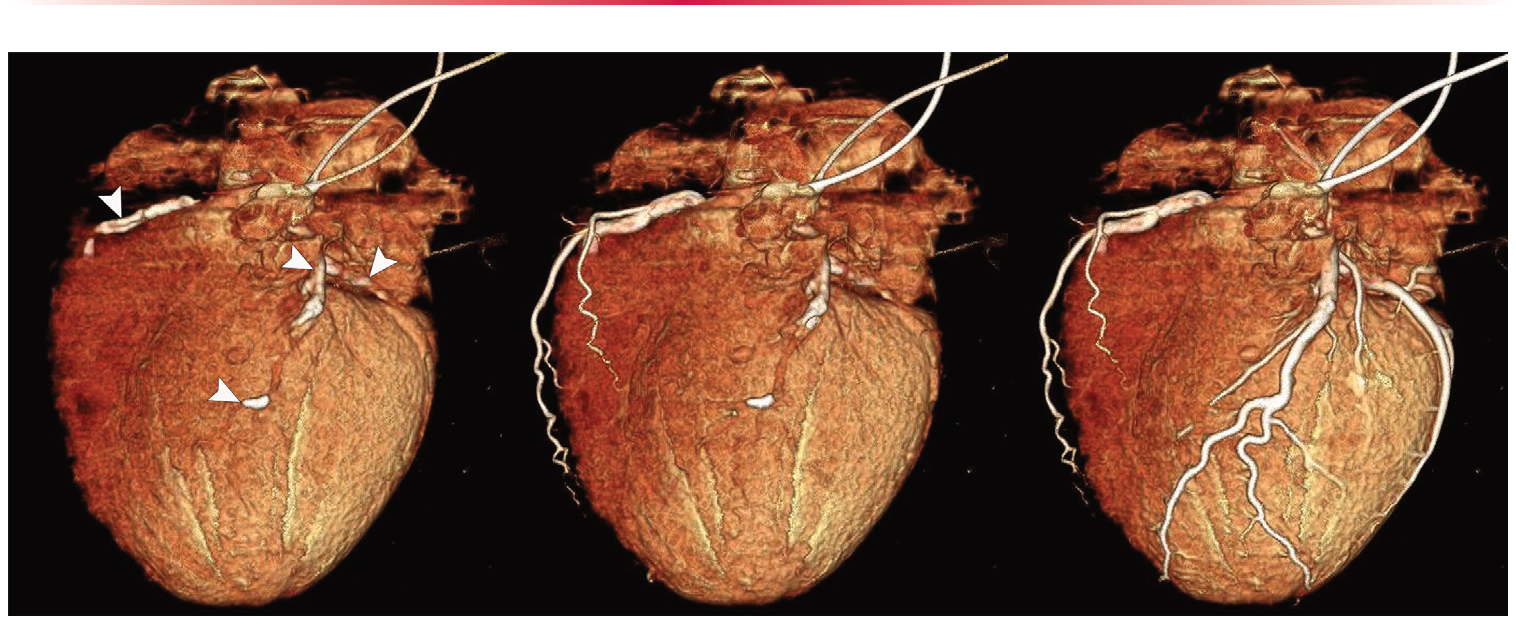 Figure 22