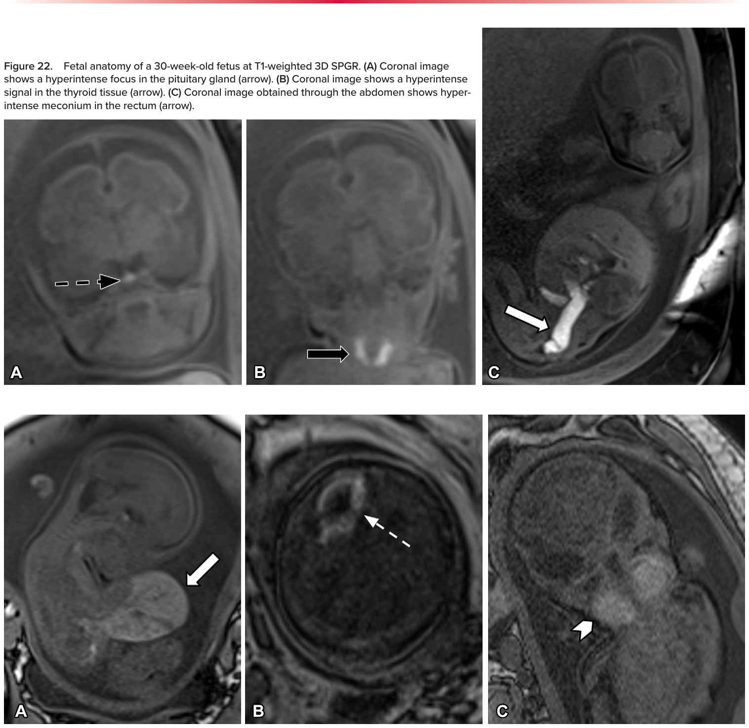 Figure 23
