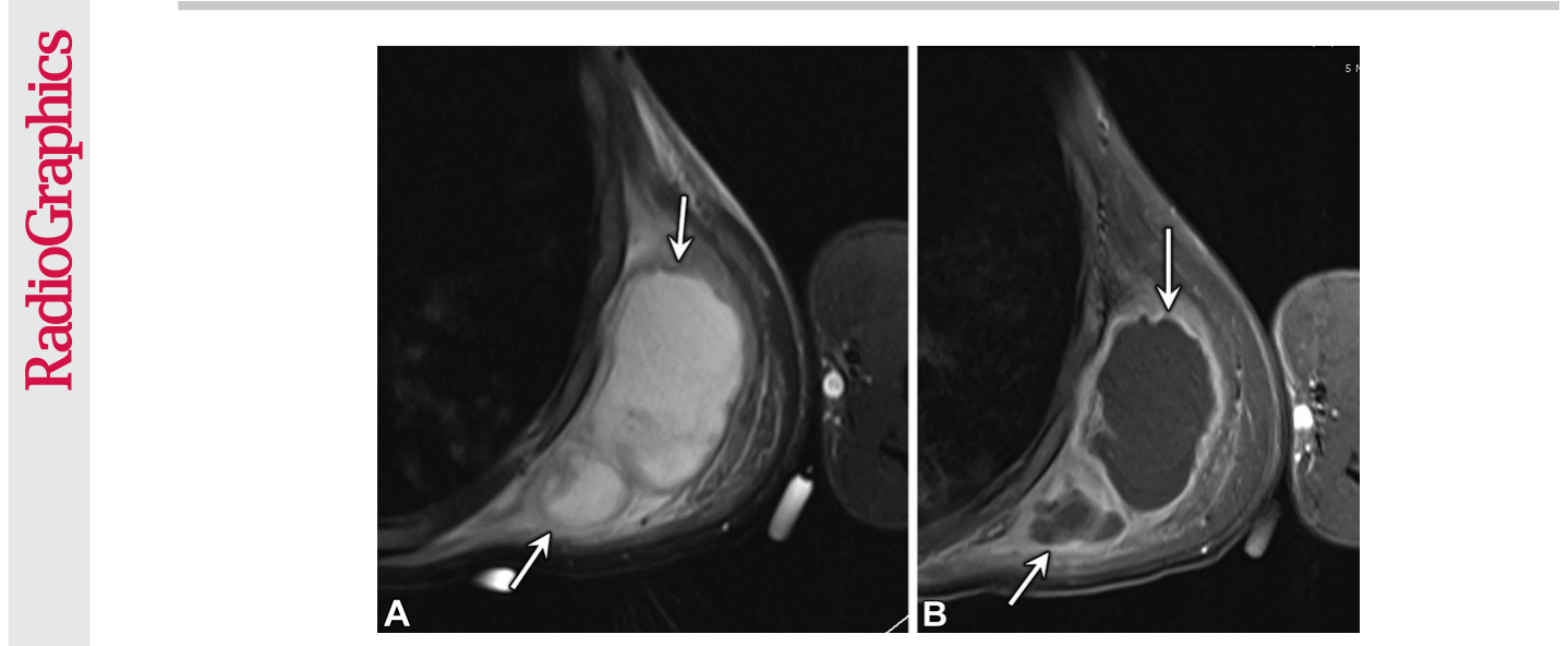 Figure 23