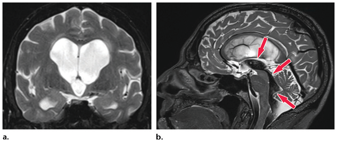 Figure 23