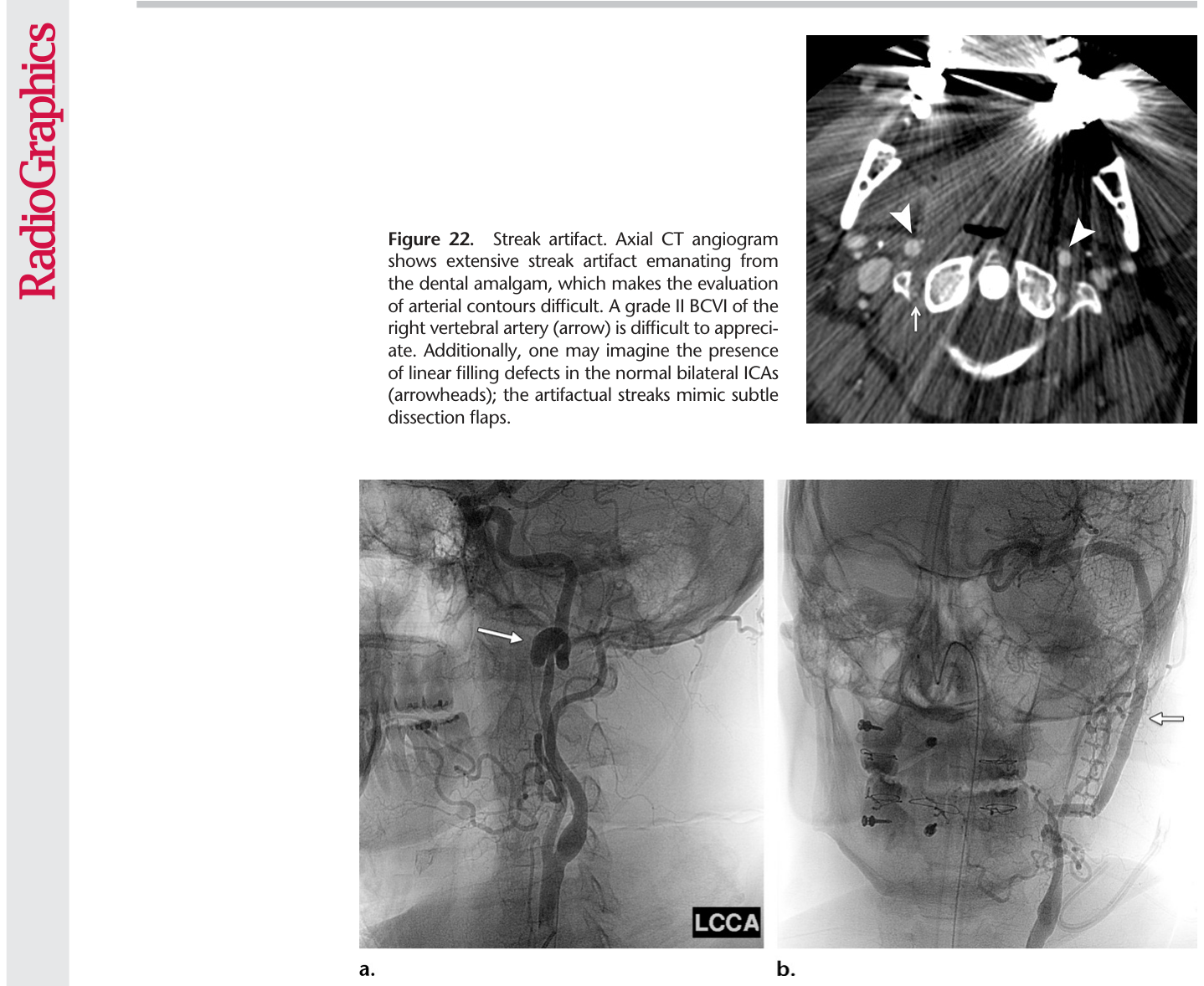Figure 23