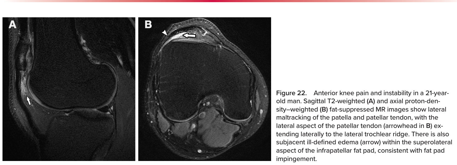 Figure 23