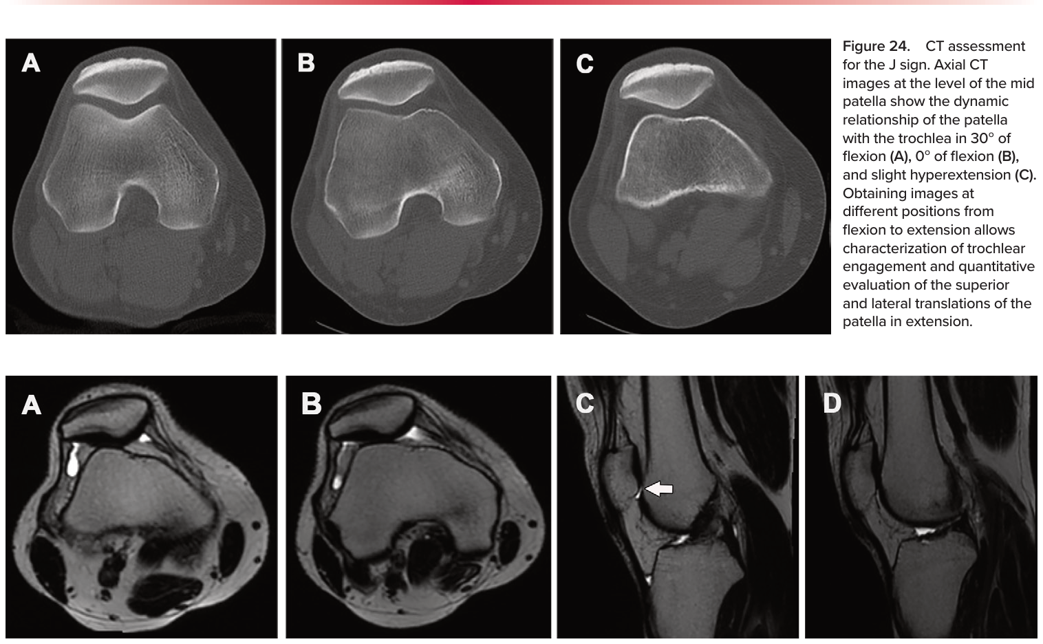 Figure 25
