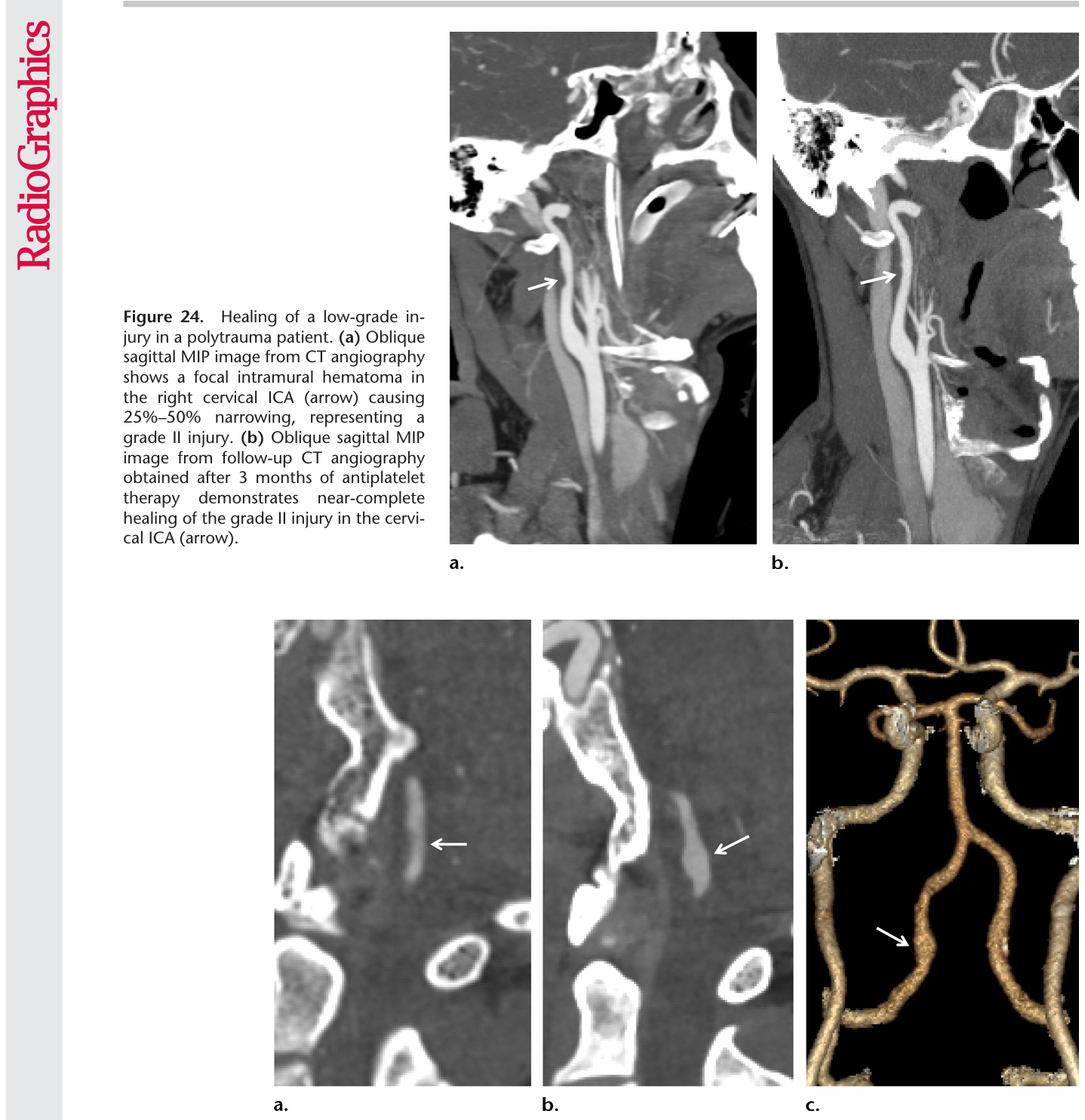 Figure 25
