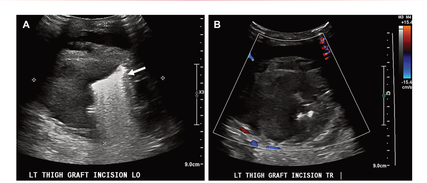 Figure 25