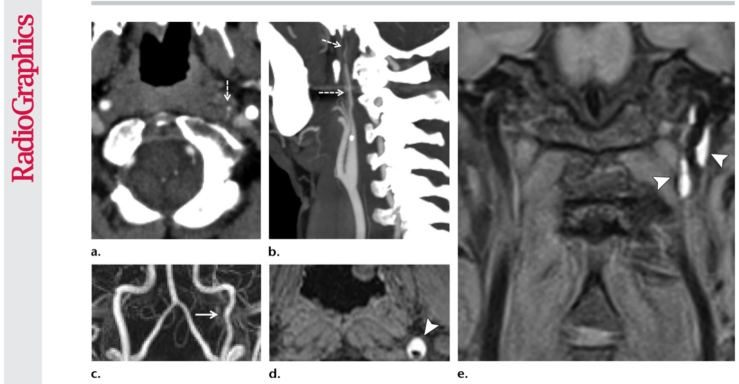 Figure 26