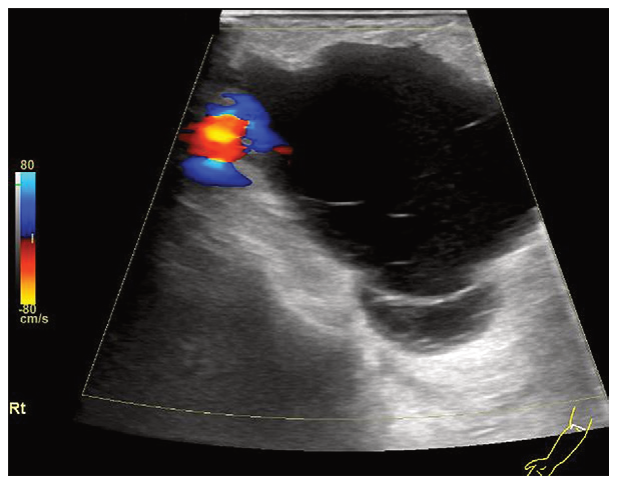 Figure 26