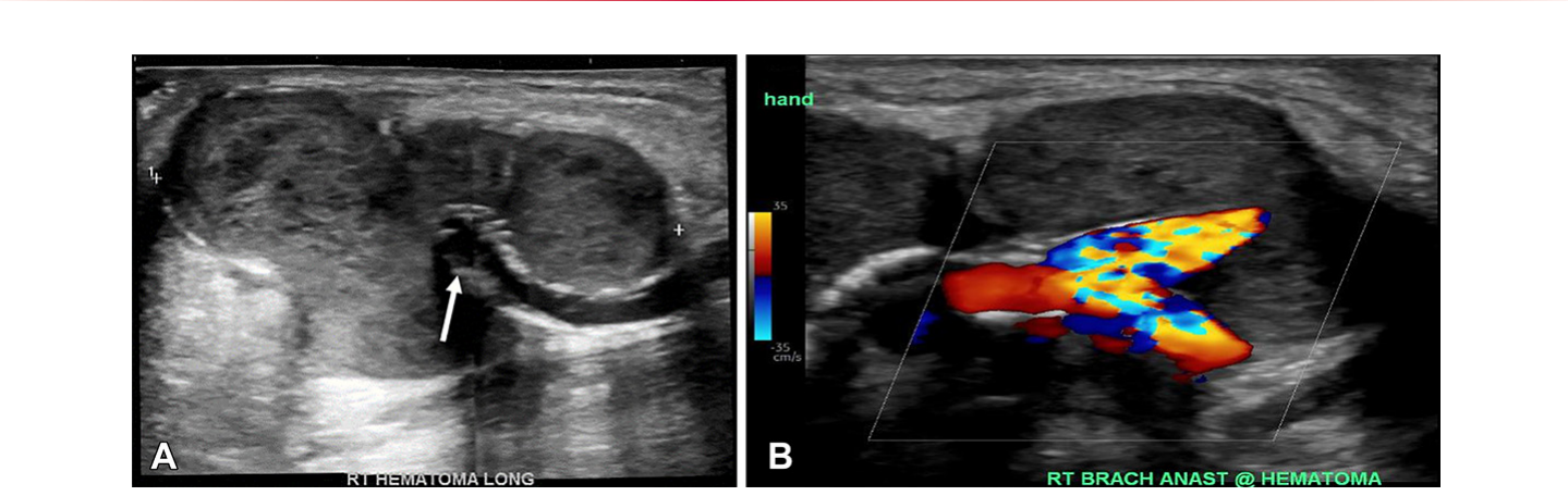 Figure 27
