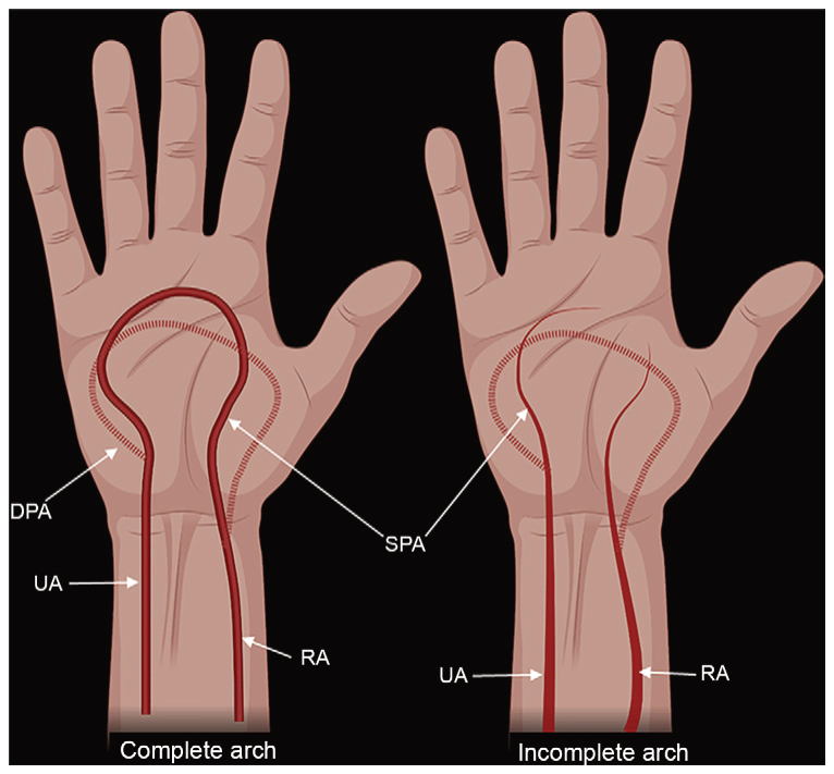 Figure 9