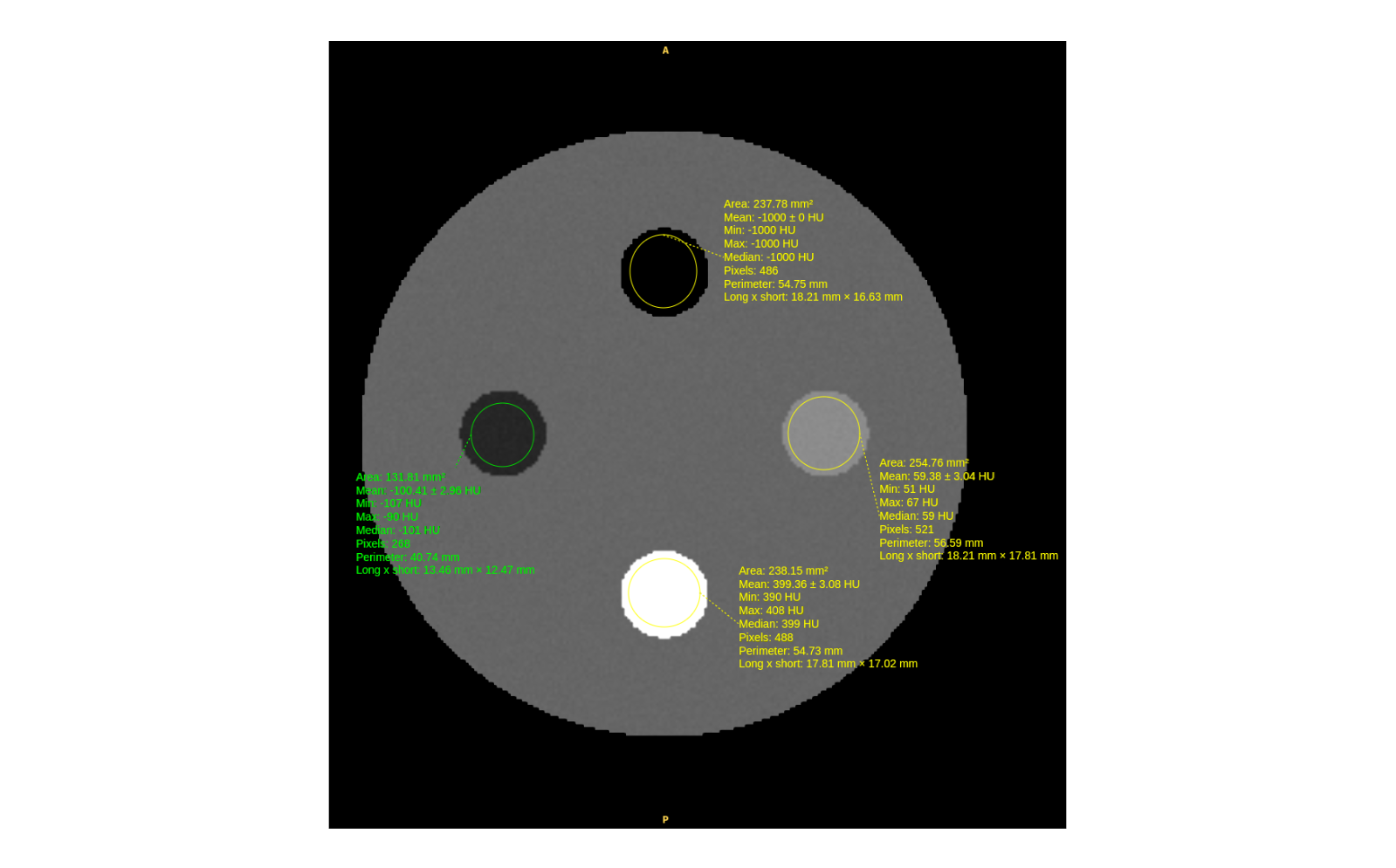 03-roi-inserts