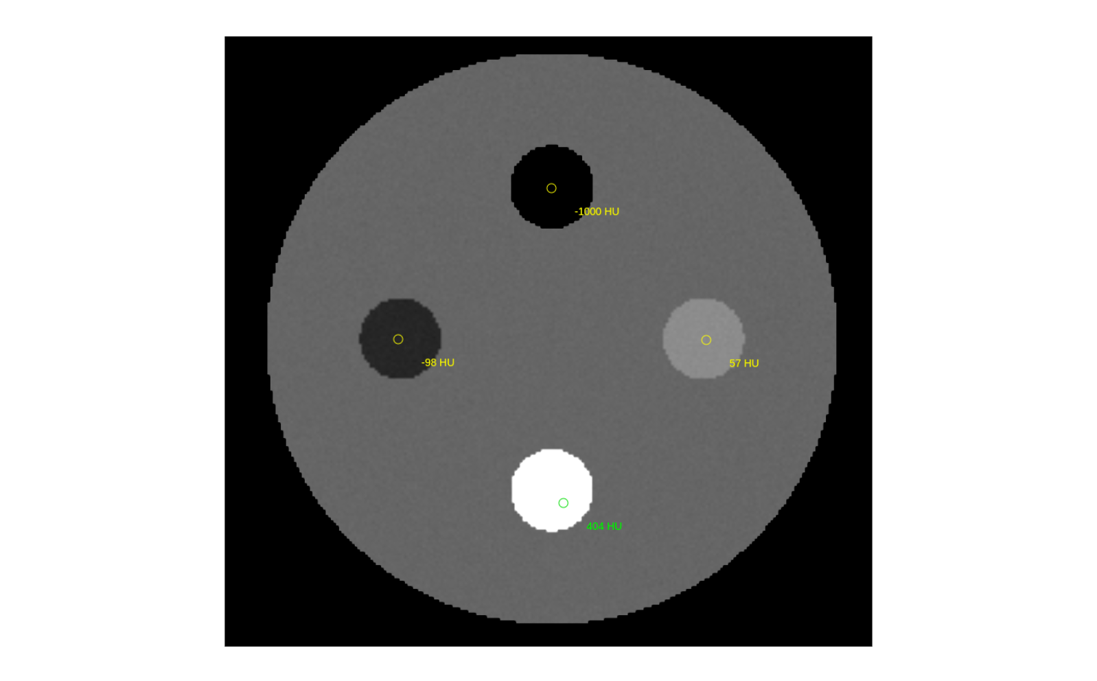 03-value-inserts
