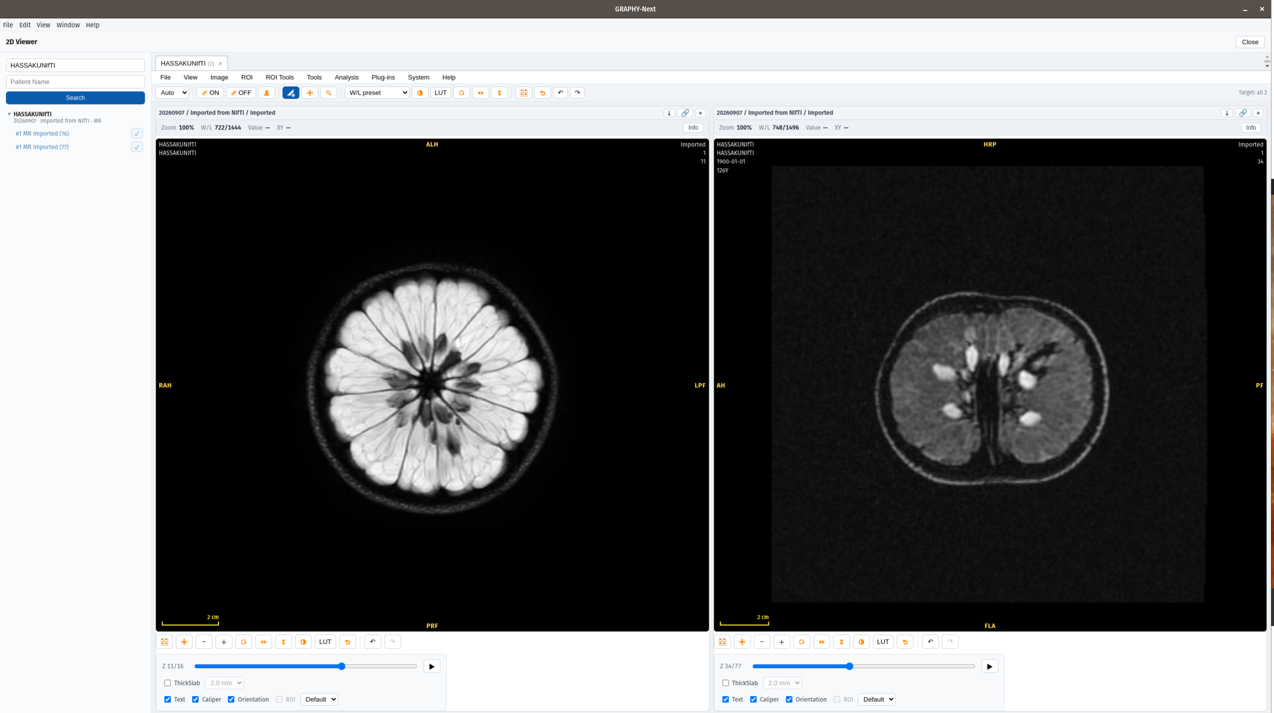 06-nifti-viewer