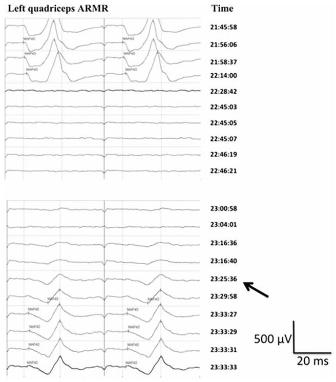 Figure 17