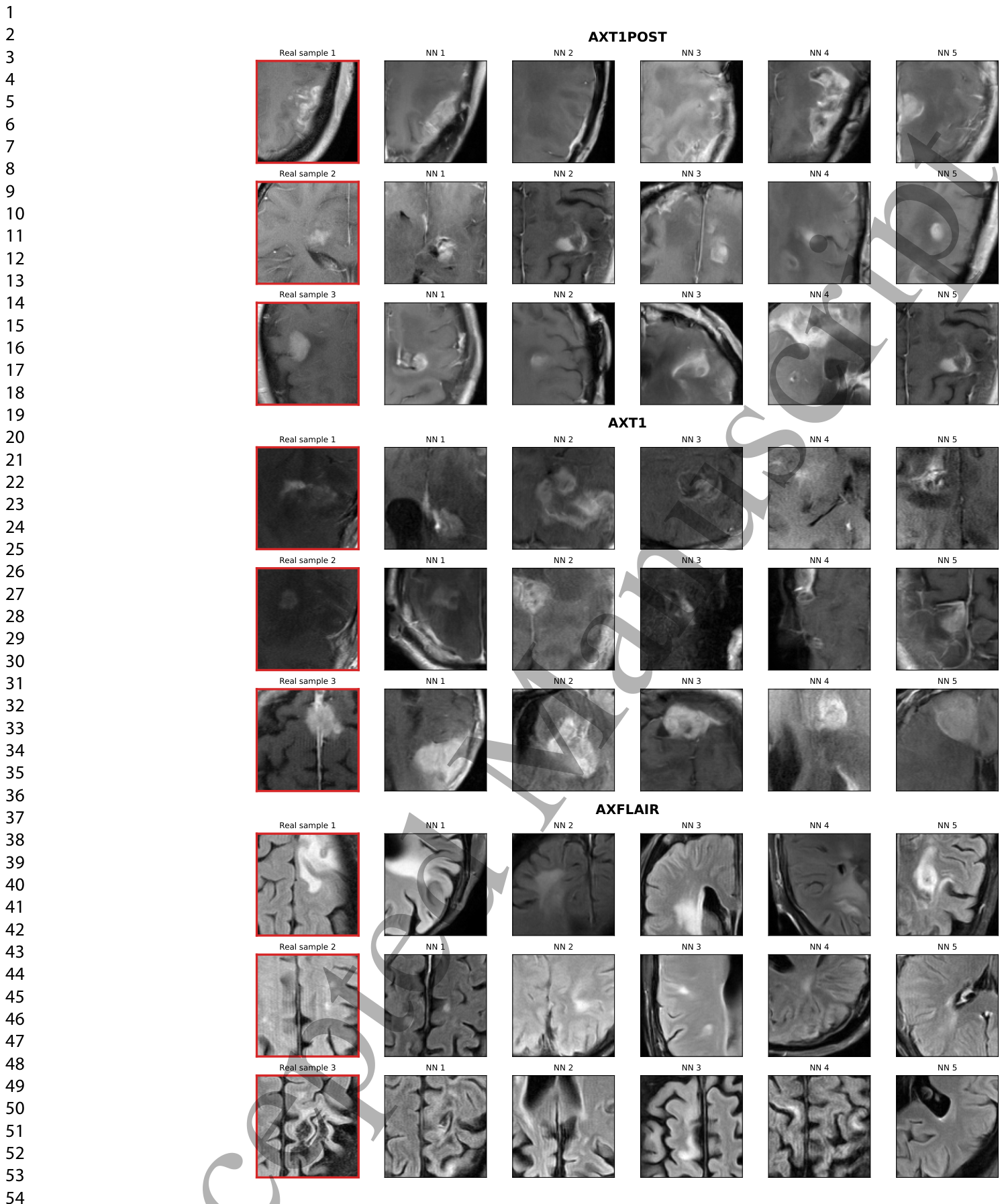Figure 14